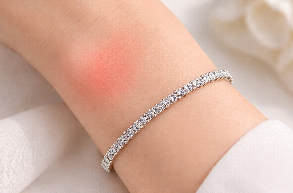 Bijoux allergie nickel : comment choisir sans risque