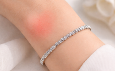 Bijoux allergie nickel : comment choisir sans risque